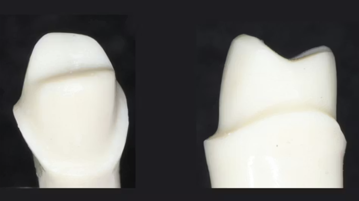 vai-tro-cua-sua-soan-cui-rang-trong-do-ben-lau-dai-cua-mao-su