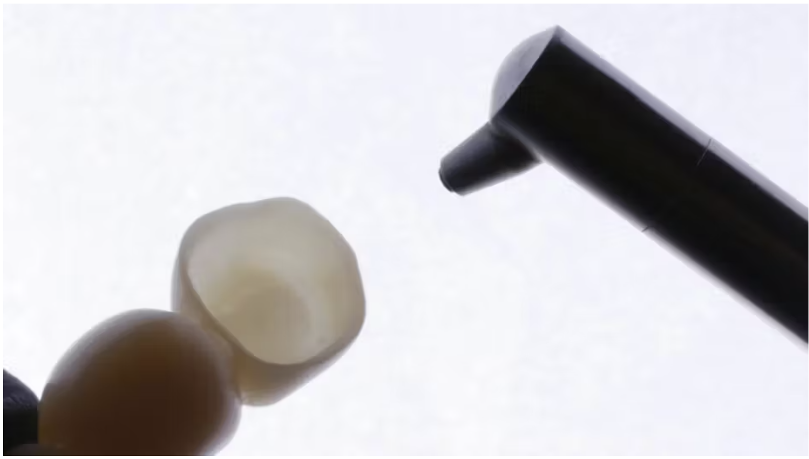 Sử dụng xi măng Fuji Cem cho phục hình zirconia - Quy Trình Chuẩn Giúp Tăng Độ Bền Và Ổn Định Lâu Dài