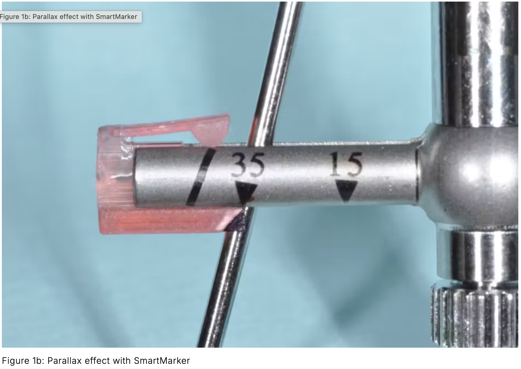 Sai số trên cây đo lực torque implant nha khoa: Nguyên nhân gây lỏng vít và giải pháp