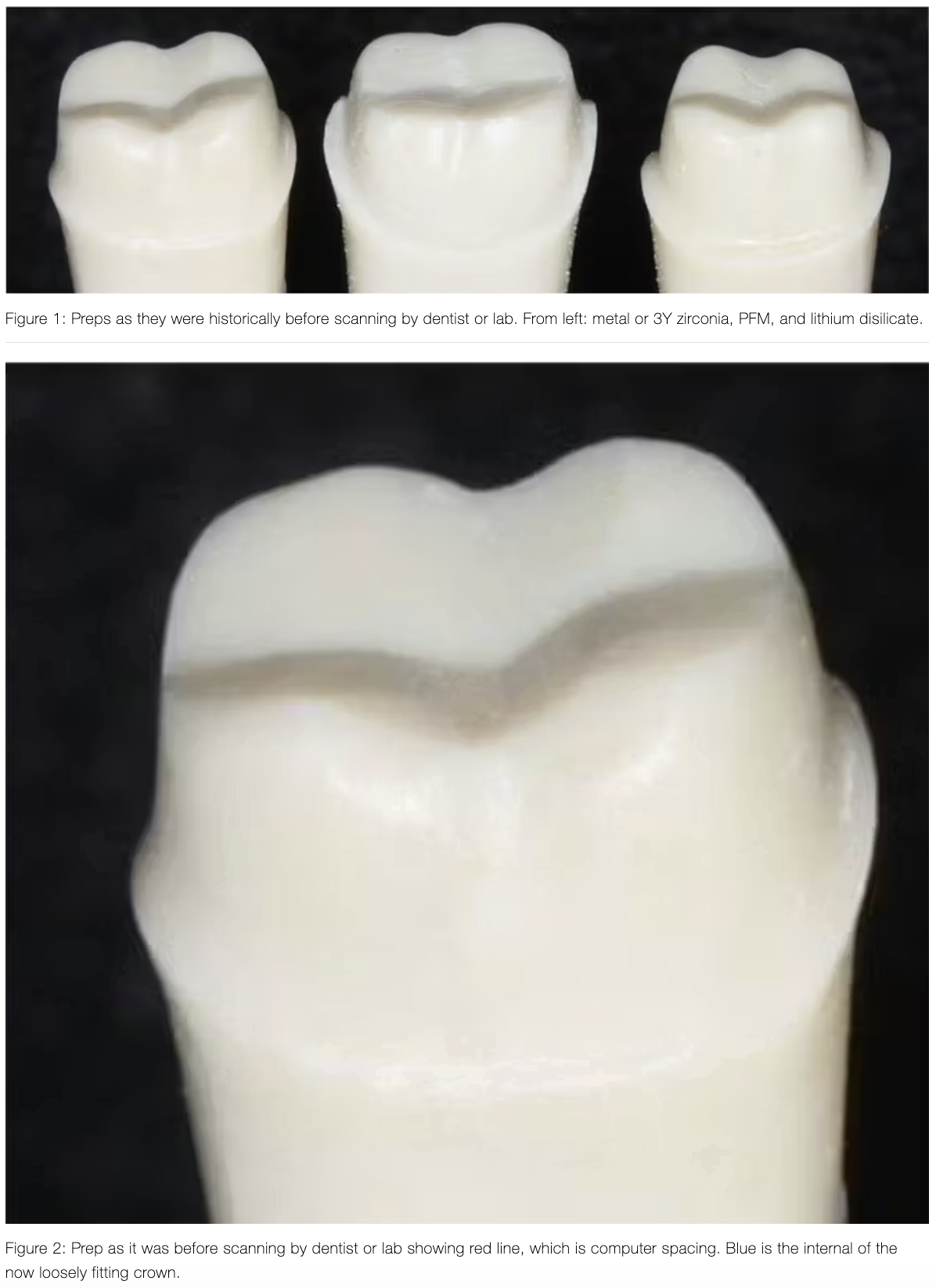 vai-tro-cua-sua-soan-cui-rang-trong-do-ben-lau-dai-cua-mao-su