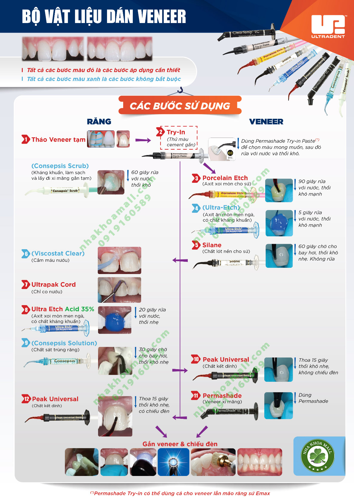 Bộ vật liệu gắn veneer Ultradent – Bí quyết để có phục hình bền vững