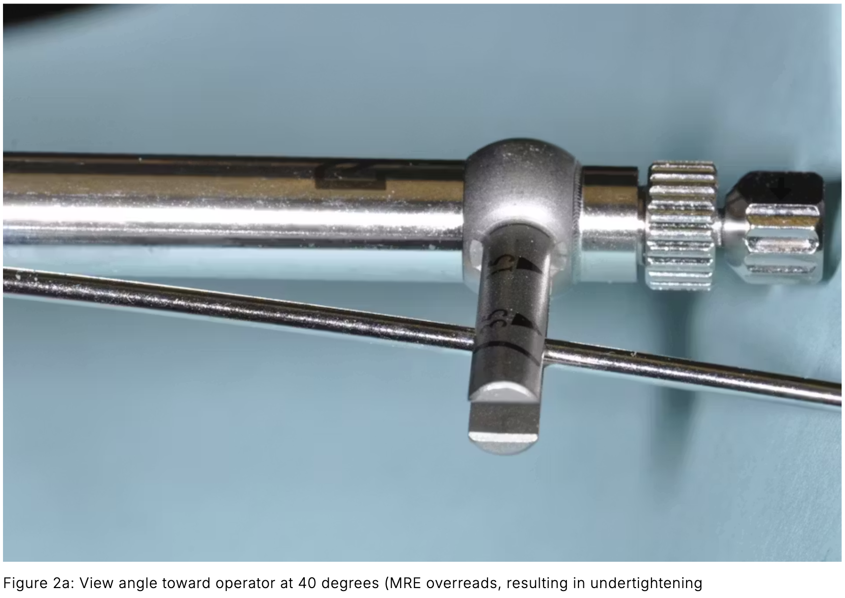 Sai số trên cây đo lực torque implant nha khoa: Nguyên nhân gây lỏng vít và giải pháp
