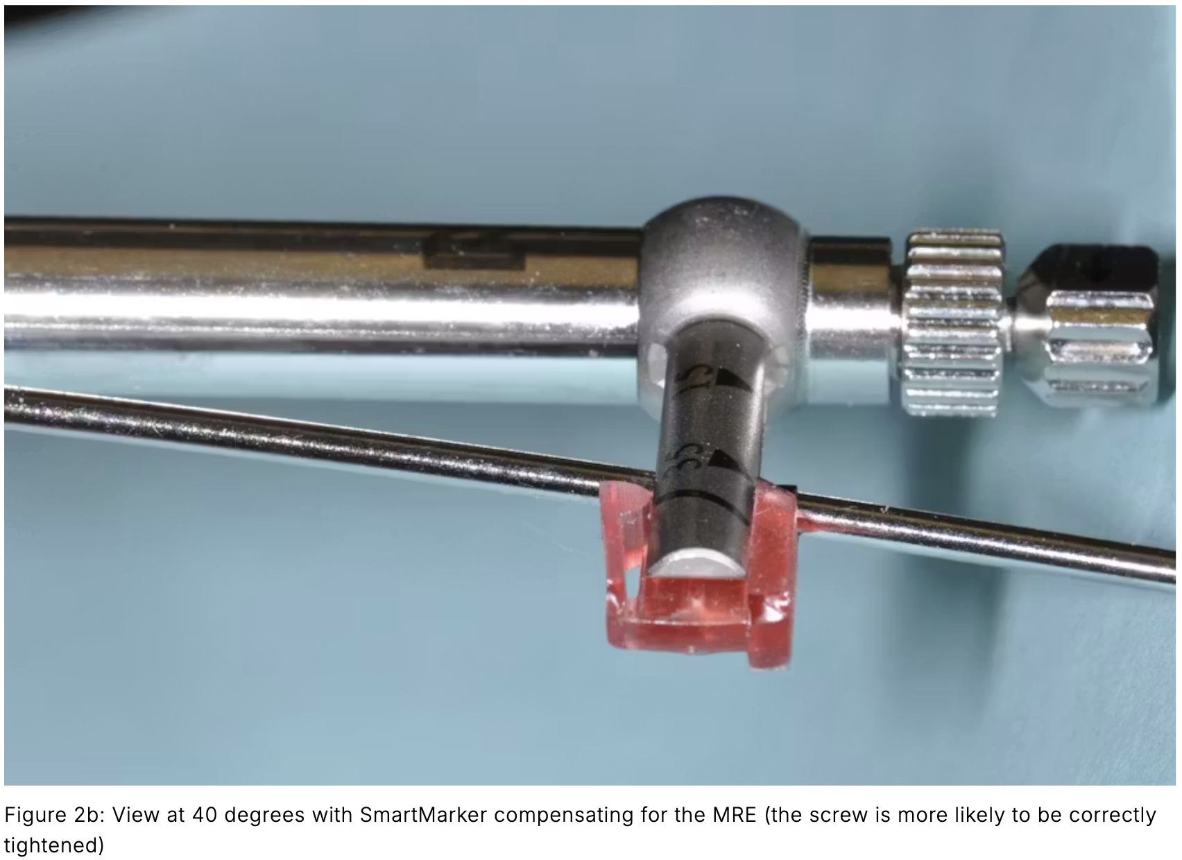 Sai số trên cây đo lực torque implant nha khoa: Nguyên nhân gây lỏng vít và giải pháp