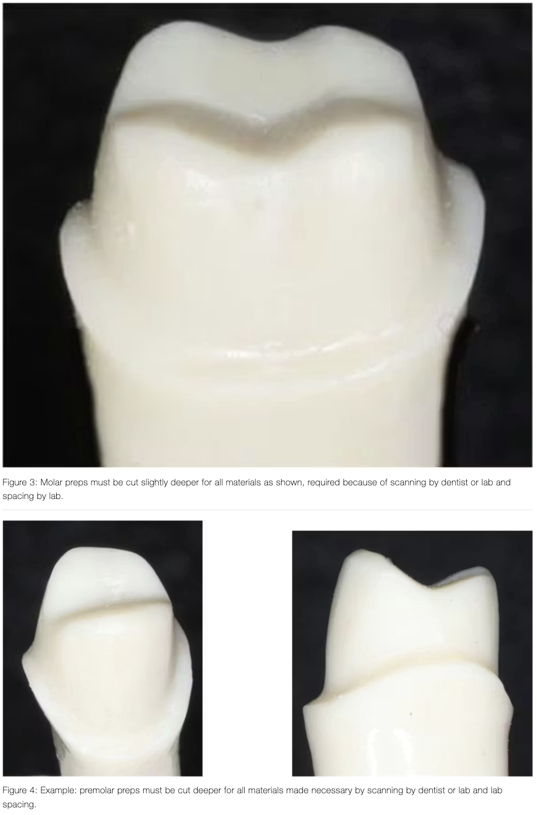 vai-tro-cua-sua-soan-cui-rang-trong-do-ben-lau-dai-cua-mao-su