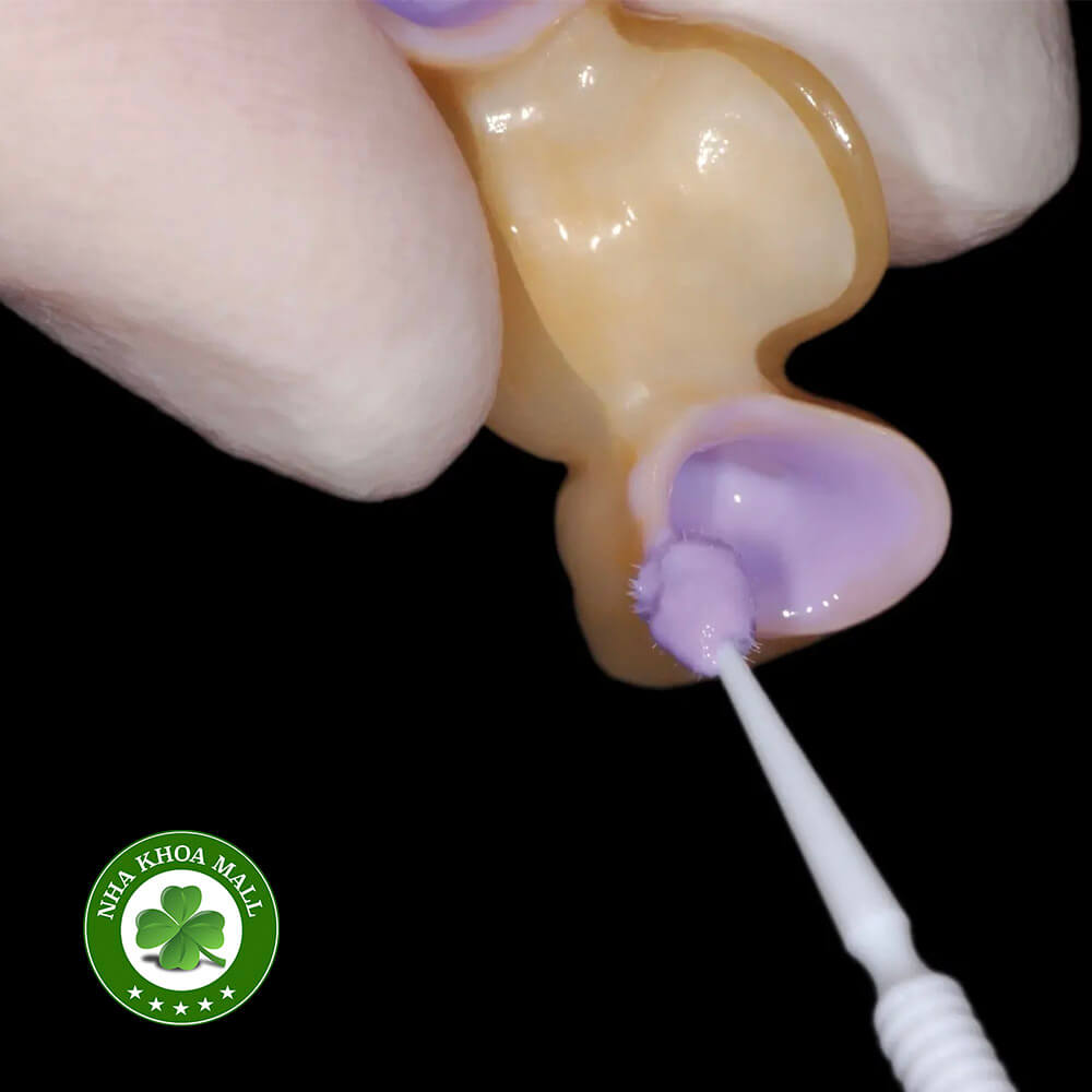 Sử dụng xi măng Fuji Cem cho phục hình zirconia - Quy Trình Chuẩn Giúp Tăng Độ Bền Và Ổn Định Lâu Dài
