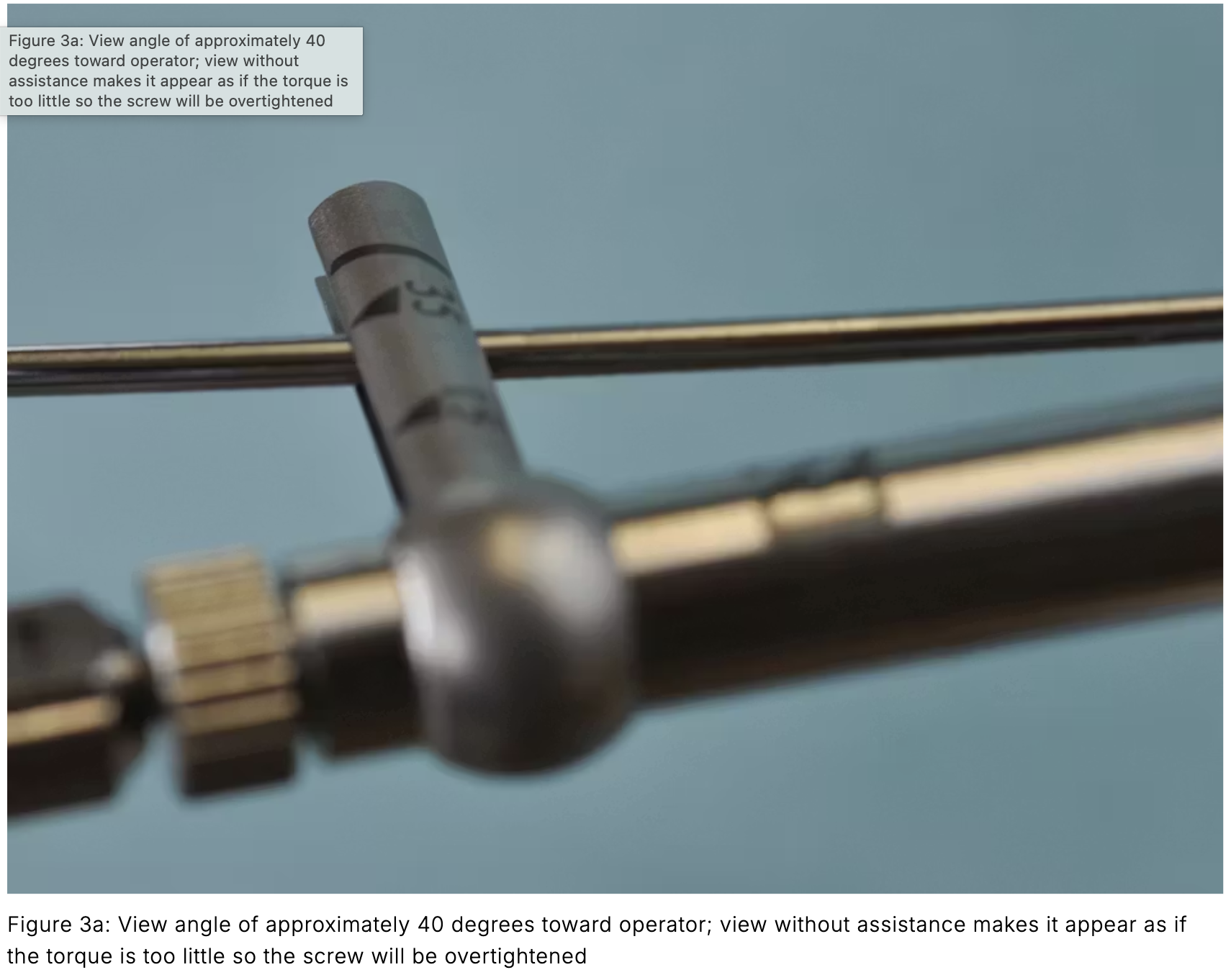 Sai số trên cây đo lực torque implant nha khoa: Nguyên nhân gây lỏng vít và giải pháp