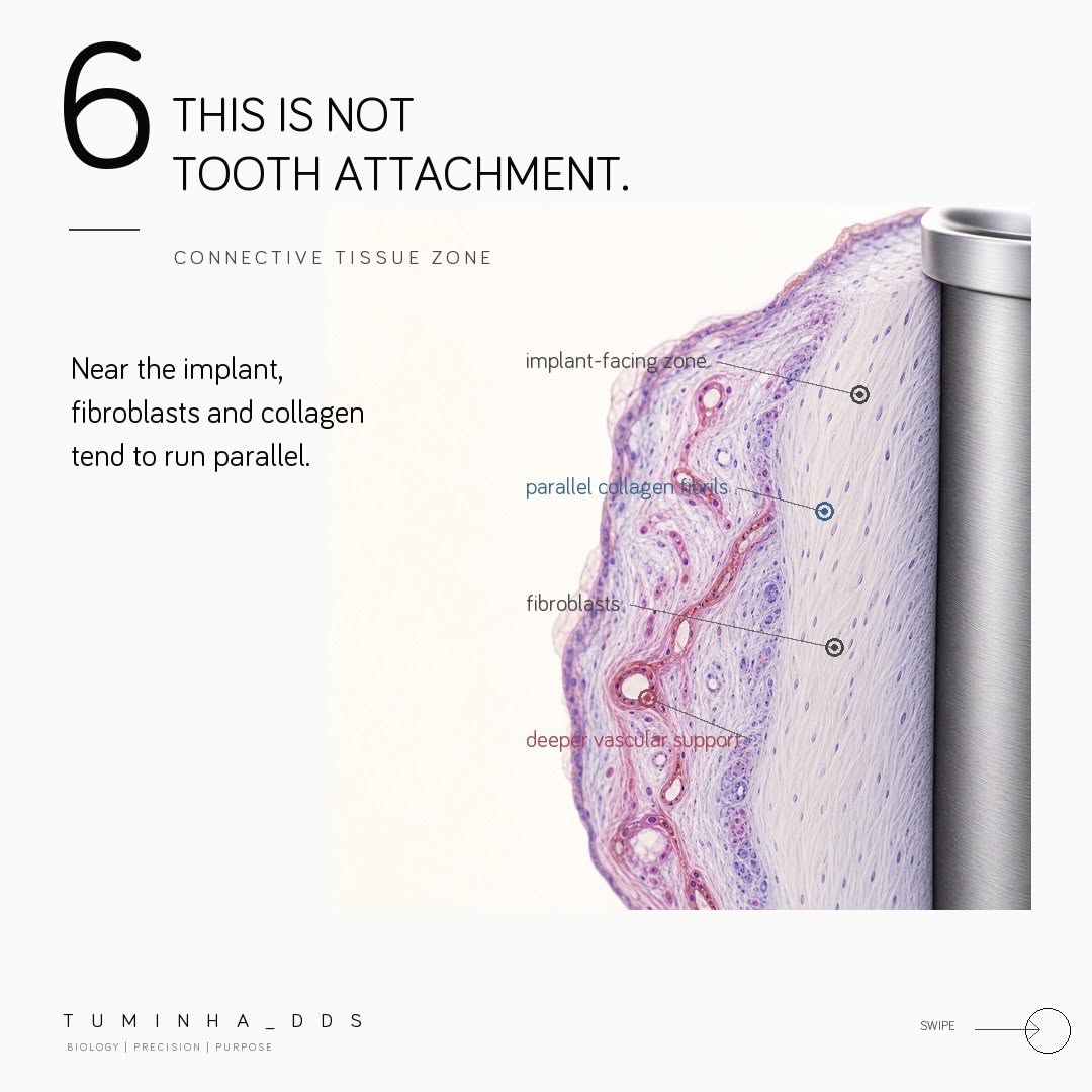 Vùng xuyên niêm mạc quanh Implant: Hàng rào sinh học quyết định sự thành công lâu dài của cấy ghép nha khoa
