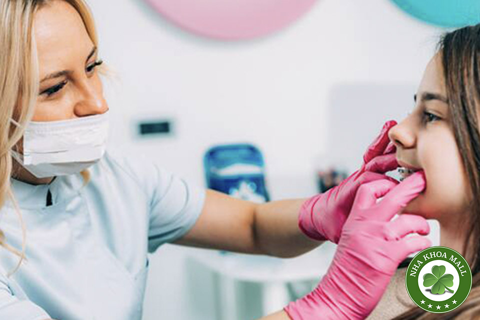 4 Mẹo Vàng Giúp Ngăn Ngừa Sâu Răng Khi Đeo Mắc Cài Niềng Răng
