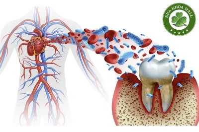 Mối Liên Hệ Giữa Sức Khỏe Nướu và Bệnh Tim: Những Điều Bạn Cần Biết