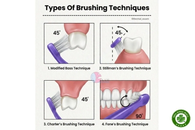 Các kỹ thuật chải răng đúng cách - lựa chọn phù hợp để bảo vệ sức khỏe răng miệng