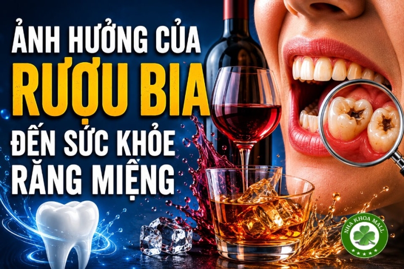 Ảnh hưởng của việc tiêu thụ rượu bia đối với sức khỏe răng miệng