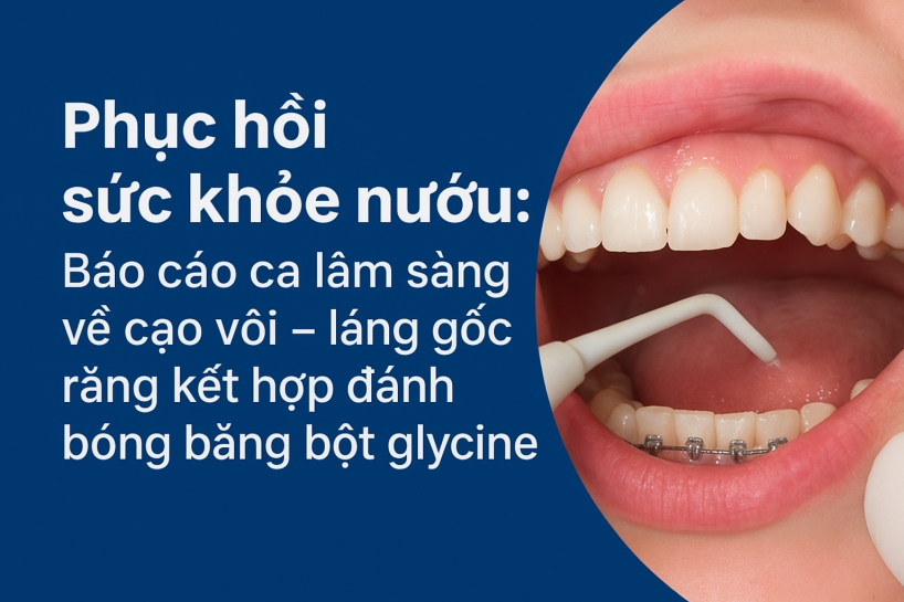 Case lâm sàng về cạo vôi kết hợp đánh bóng bằng bột glycine
