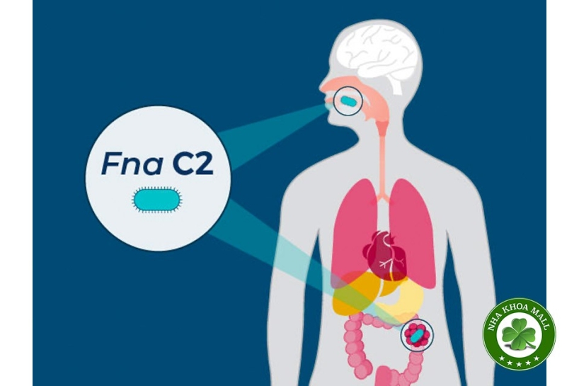 Vi khuẩn miệng và ung thư đại trực tràng: Mối liên hệ mà chúng ta hiếm khi nói đến