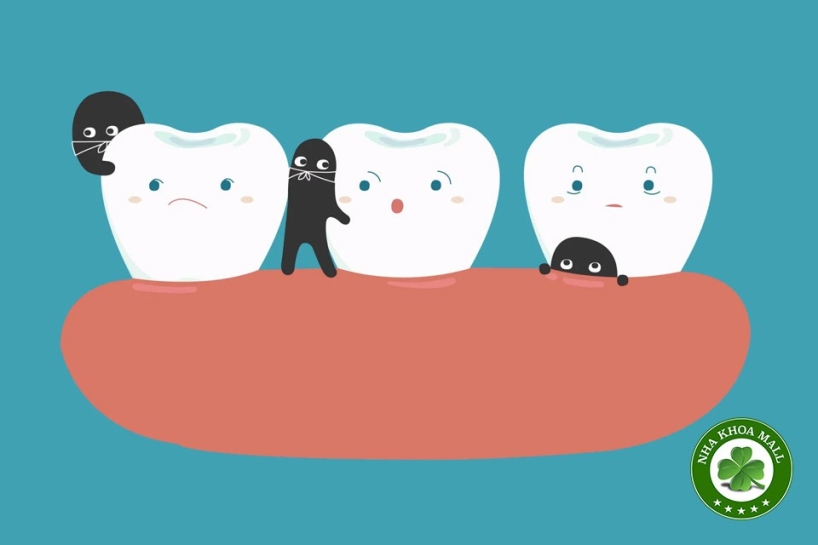 Bốn cách phòng ngừa sâu răng ở bệnh nhân nguy cơ cao