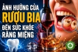Ảnh hưởng của việc tiêu thụ rượu bia đối với sức khỏe răng miệng