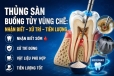 Thủng sàn buồng tủy: nhận biết sớm và xử trí đúng thời điểm