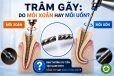 Trâm gãy trong nội nha: do mỏi xoắn hay mỏi uốn?