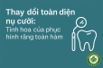 Thay đổi toàn diện nụ cười: Tinh hoa của phục hình răng toàn hàm