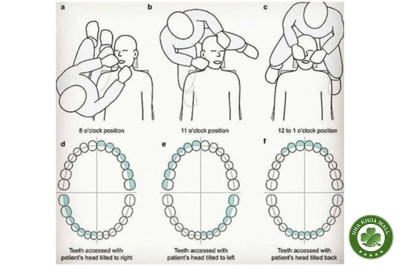 Làm sao để ngồi đúng khi điều trị răng? Tư thế mặt đồng hồ cho bác sĩ Nha Khoa