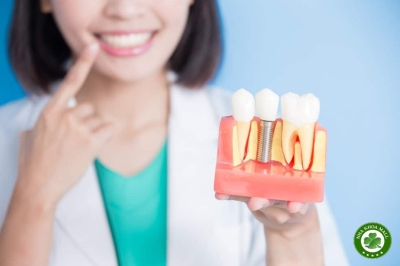 Implant không phải là răng: Tư duy mới về chăm sóc vệ sinh implant đơn lẻ và phục hình toàn hàm