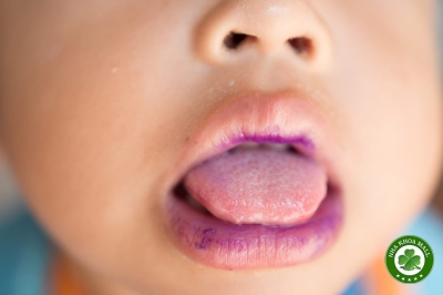 Bệnh tay chân miệng: Dấu hiệu trong miệng, biến chứng và lưu ý quan trọng khi đi khám nha khoa